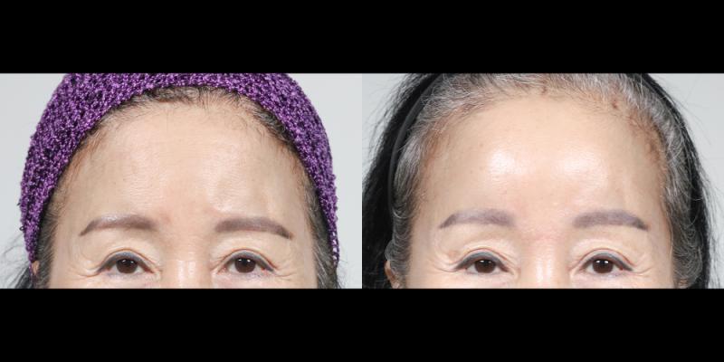 이마거상 1개월