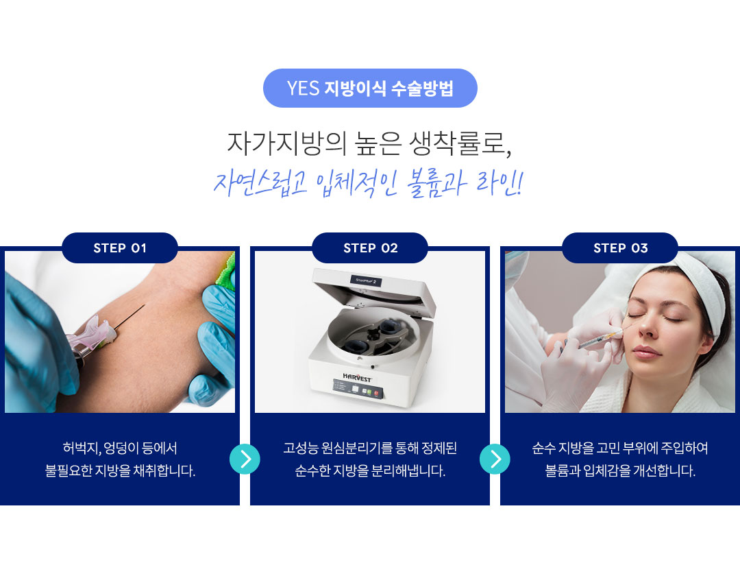 지방이식 수술방법