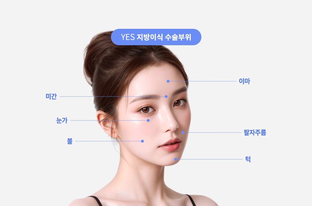 지방이식 수술부위