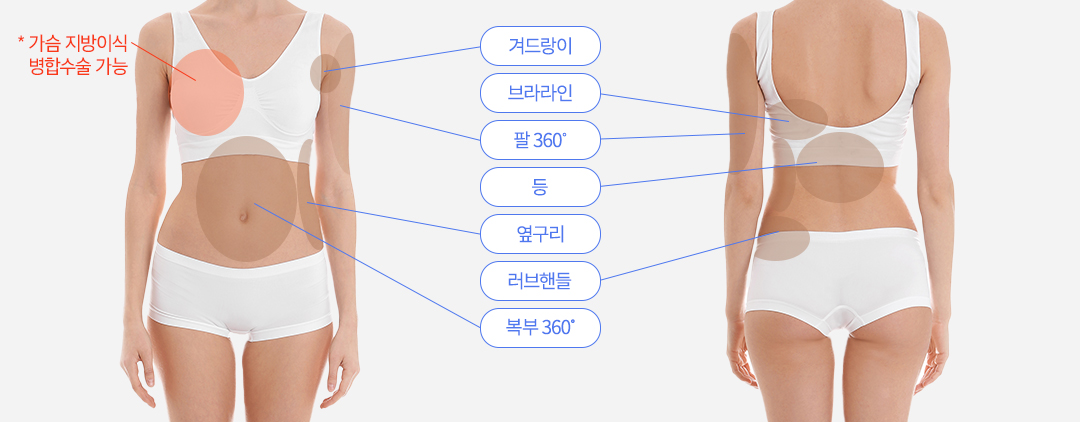 지방흡입 수술부위