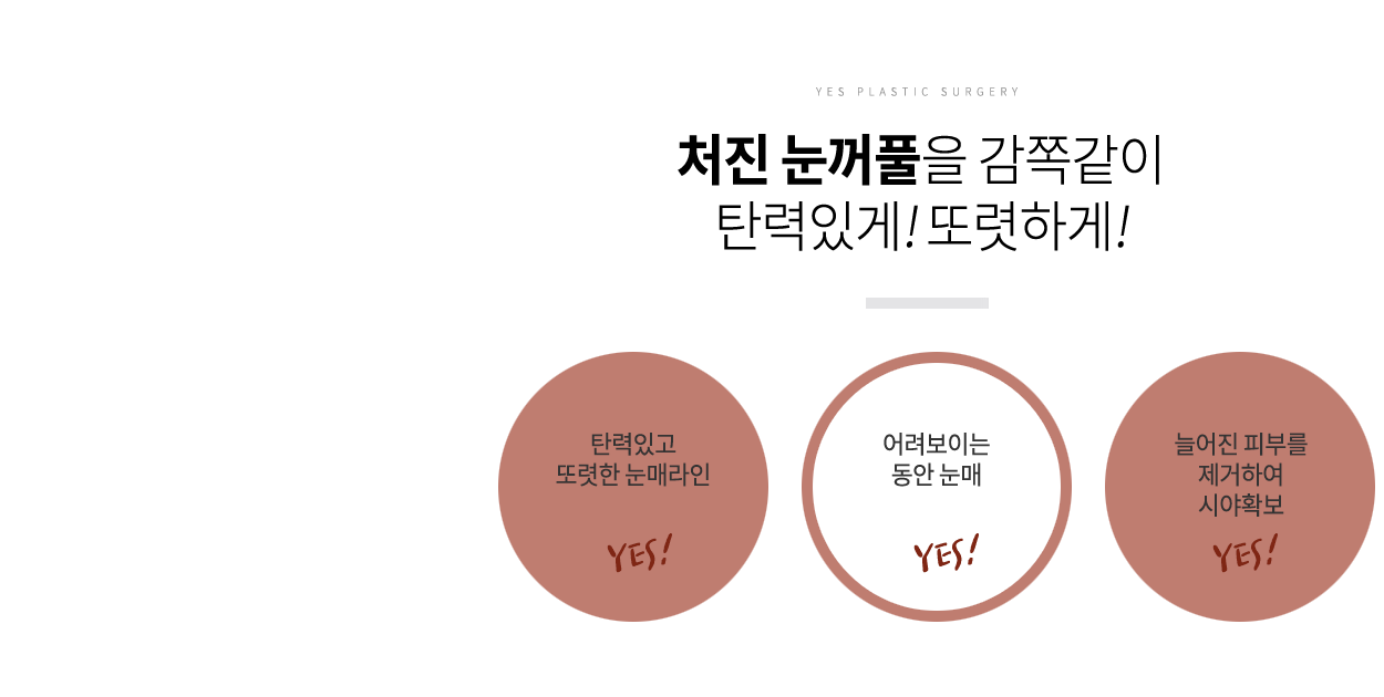 상안검성형장점