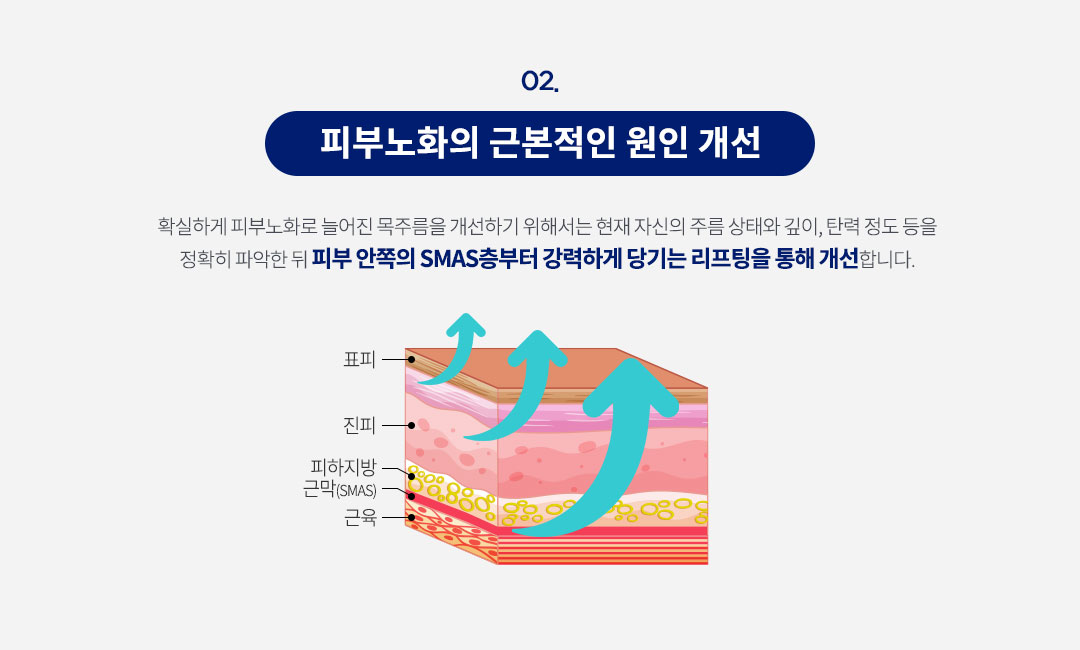 SMAS층까지 리프팅