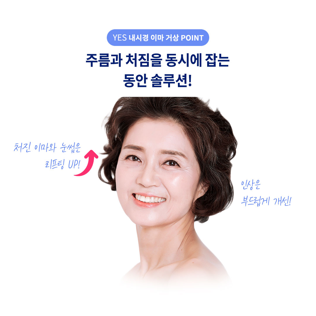 내시경 이마거상 효과