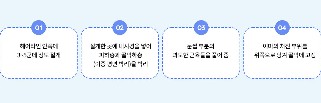 내시경 이마거상 시술과정