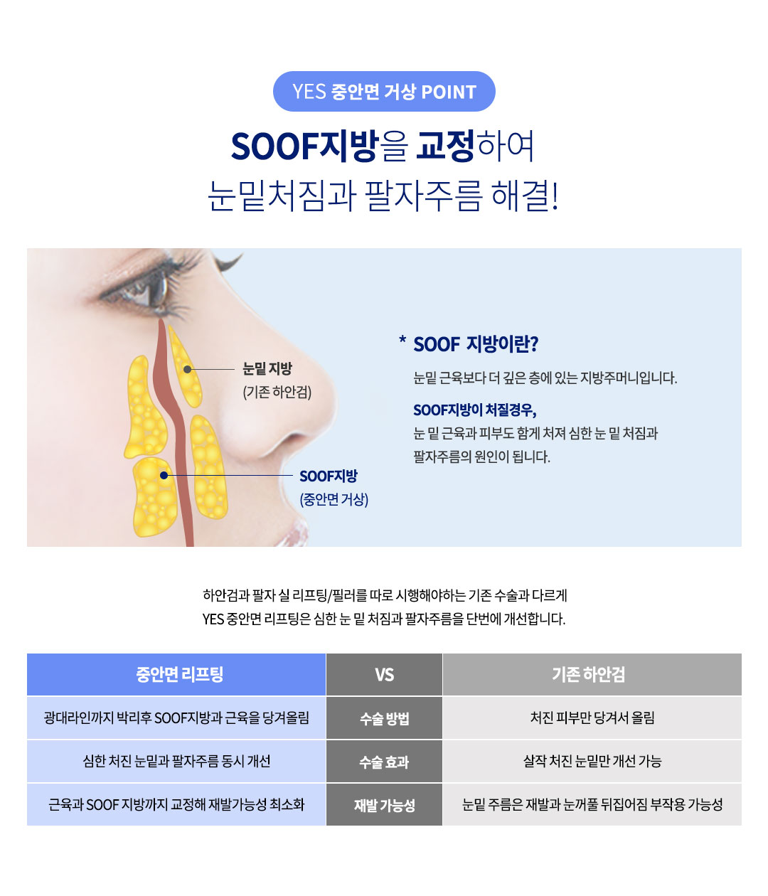 중안면거상 효과